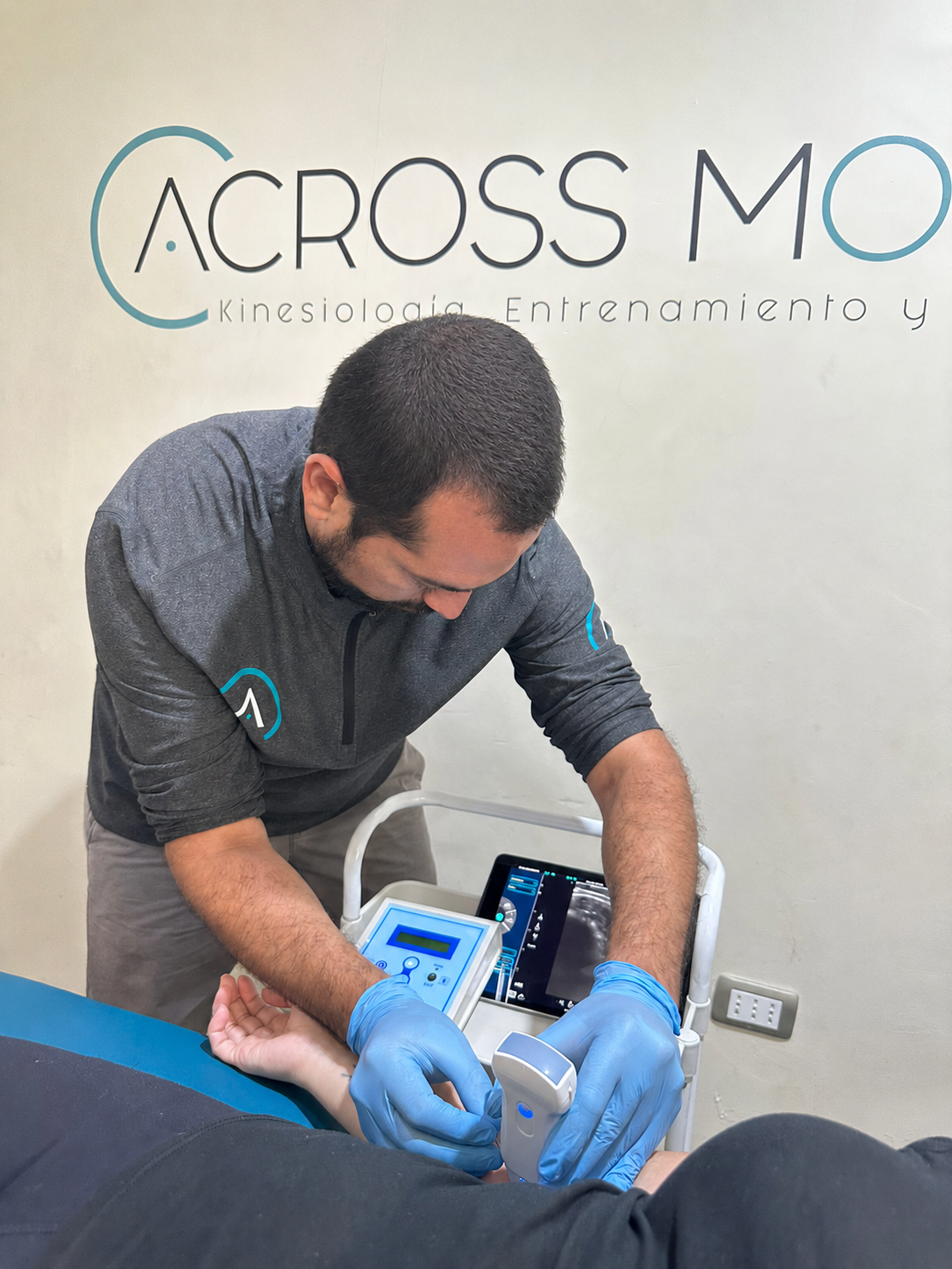 Punción seca en Across Move