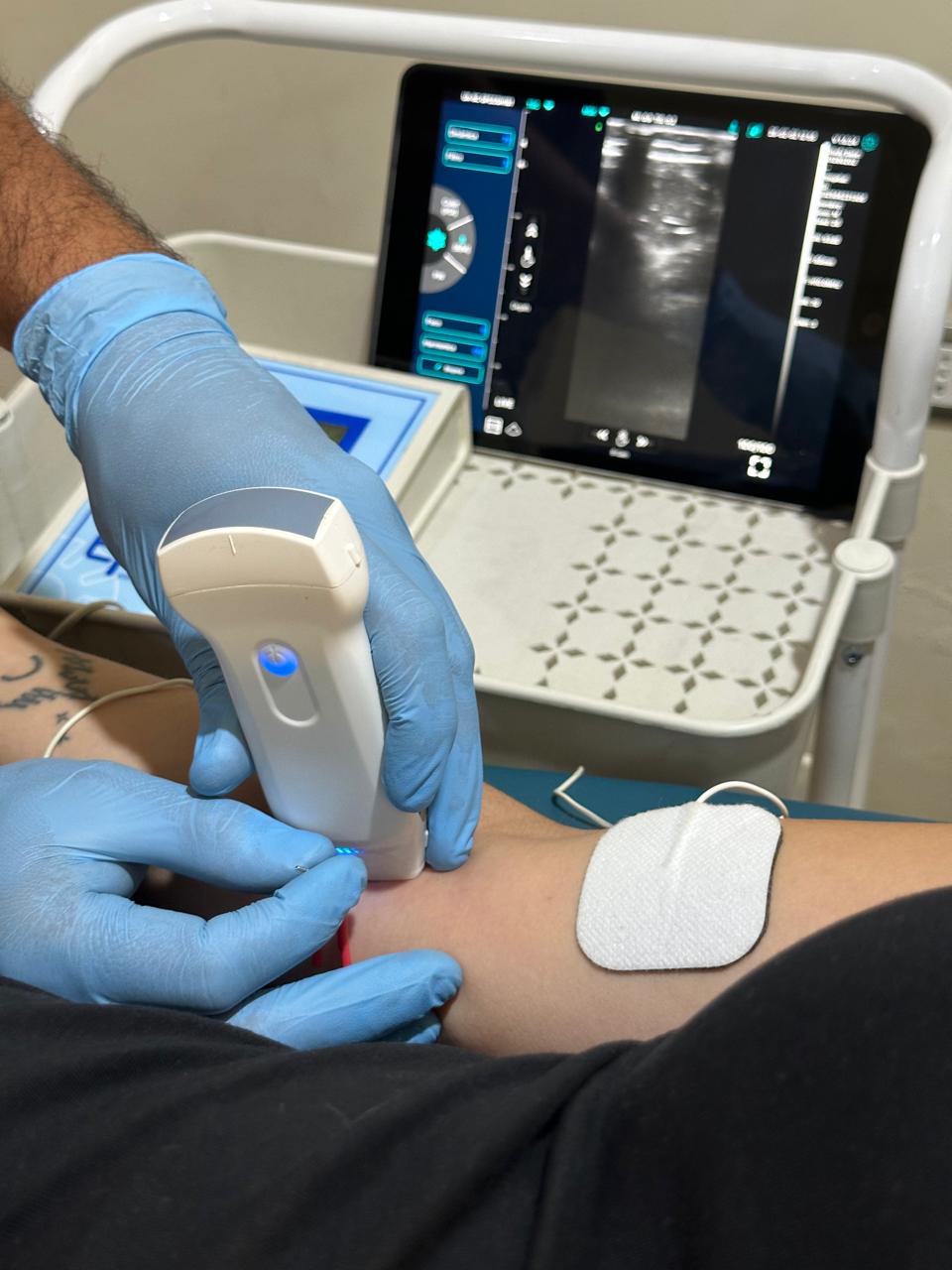 Tratamiento de fisioterapia invasiva en Across Move